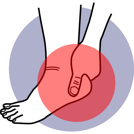 ⦁ Plantar fasciitis
